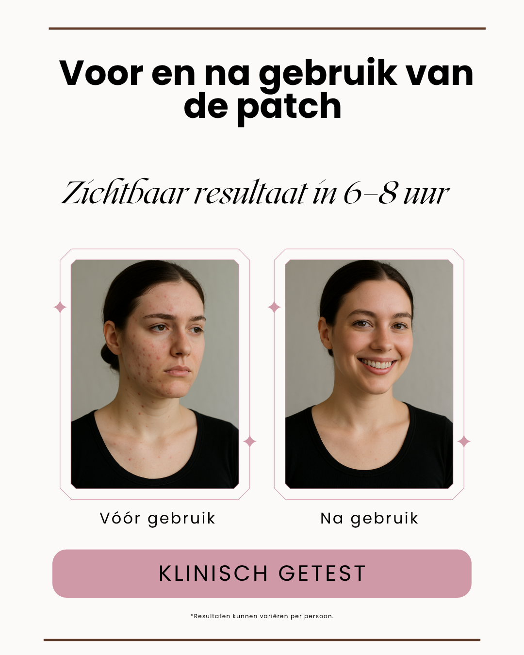 Velara Clear Dots – Weg met Puistjes in 1 Nacht