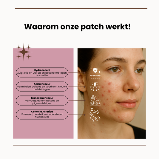 Velara Clear Dots – Weg met Puistjes in 1 Nacht